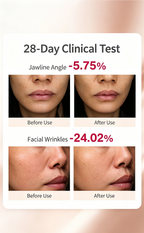 Multi-Frequency RF Facial Beauty Device, Eye & Face Dual Mode Lifting Tightening Machine, Home Anti-Aging Wrinkle Remover Skin Care Tool