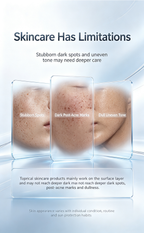 Dual-Band Black Gold Brightening Beauty Device, Sapphire Ice Cooling Facial Machine for Dark Spots, Acne Marks, Redness & Uneven Skin Tone