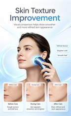 Multifunctional RF Facial Machine, Red Light Anti-Aging Blue Light Calming Skin Care Instrument